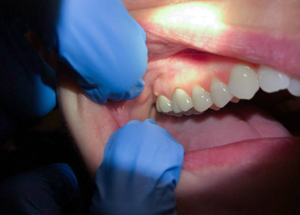Best After-Hours Emergency Dentist in Crump, TN